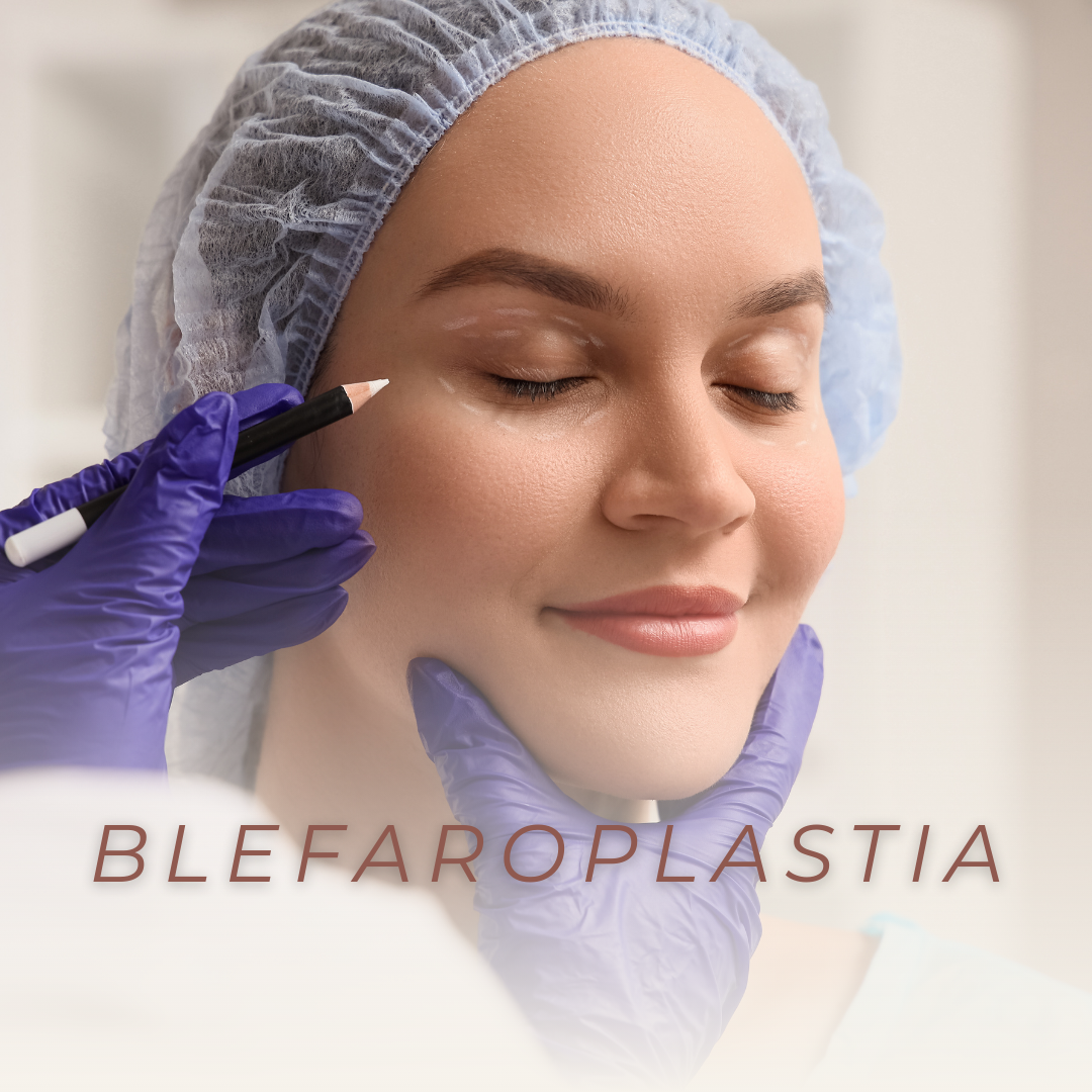 blefaroplastia
